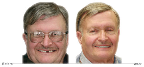 Before and After Photo