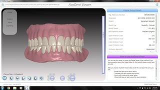 AvaDent prosthesis design in AvaDent Viewer AvaDent prosthesis design in AvaDent Viewer
