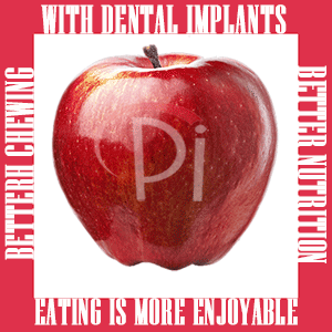 Chewing improves with dental implants making eating more enjoyable.